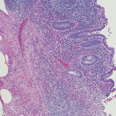 Peptides for the study of inflammation disease